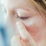 دلایل خشکی پوست در زمستان چیست؟